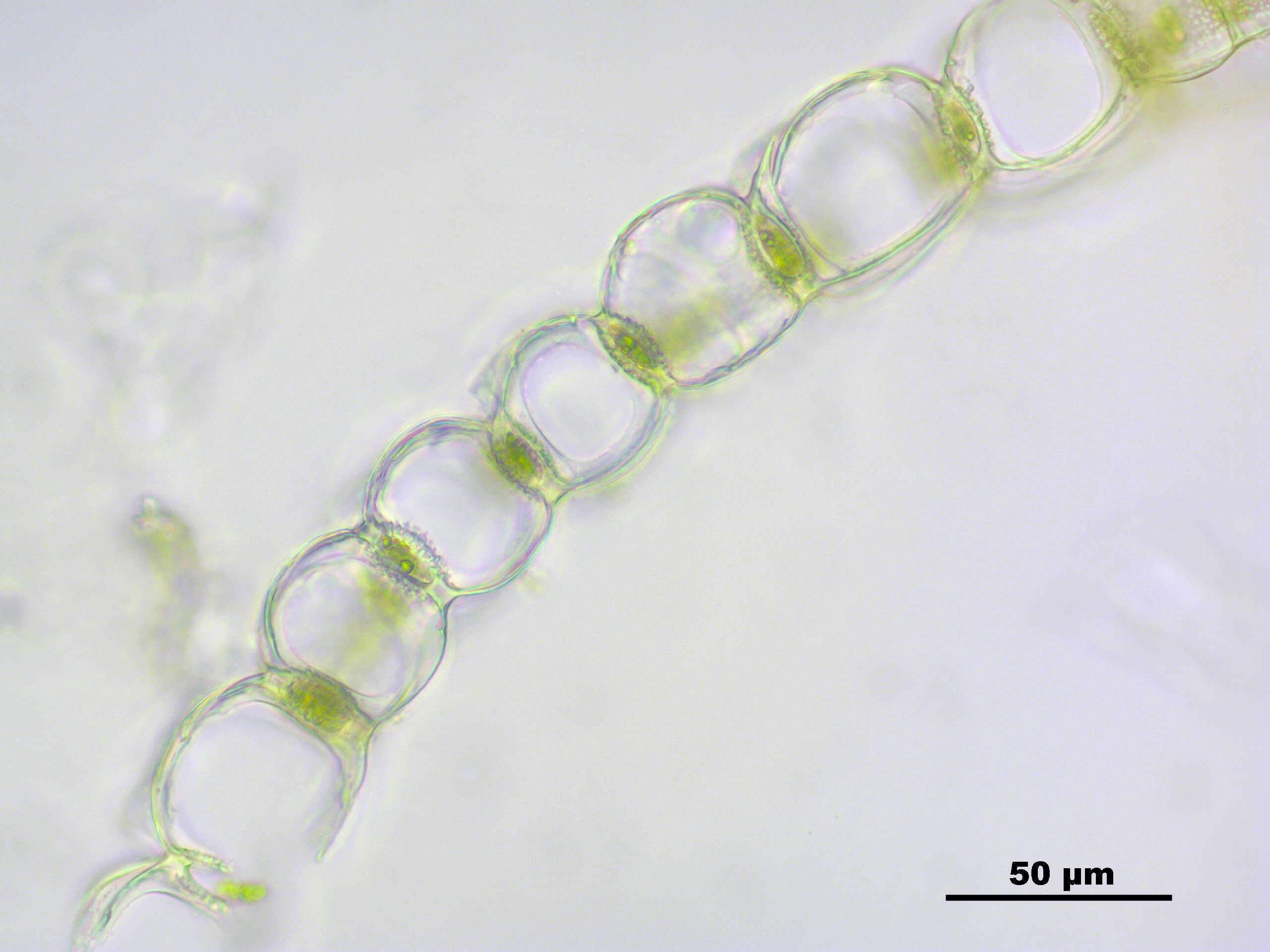 Image of papillose sphagnum