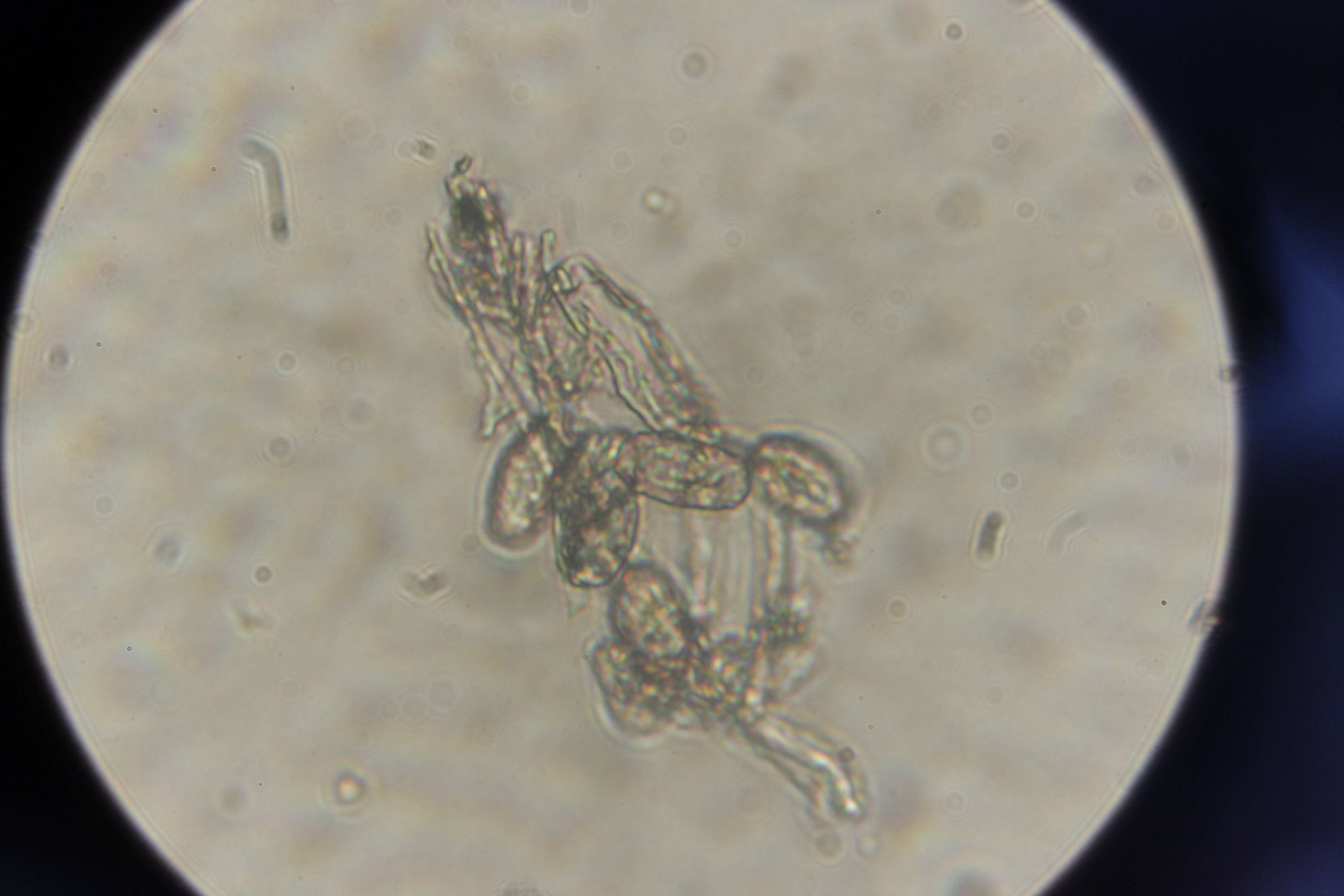 Podosphaera filipendulae (Z. Y. Zhao) T. Z. Liu & U. Braun 2010的圖片