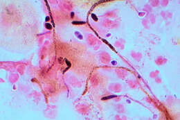 Слика од unclassified Saccharomycetales