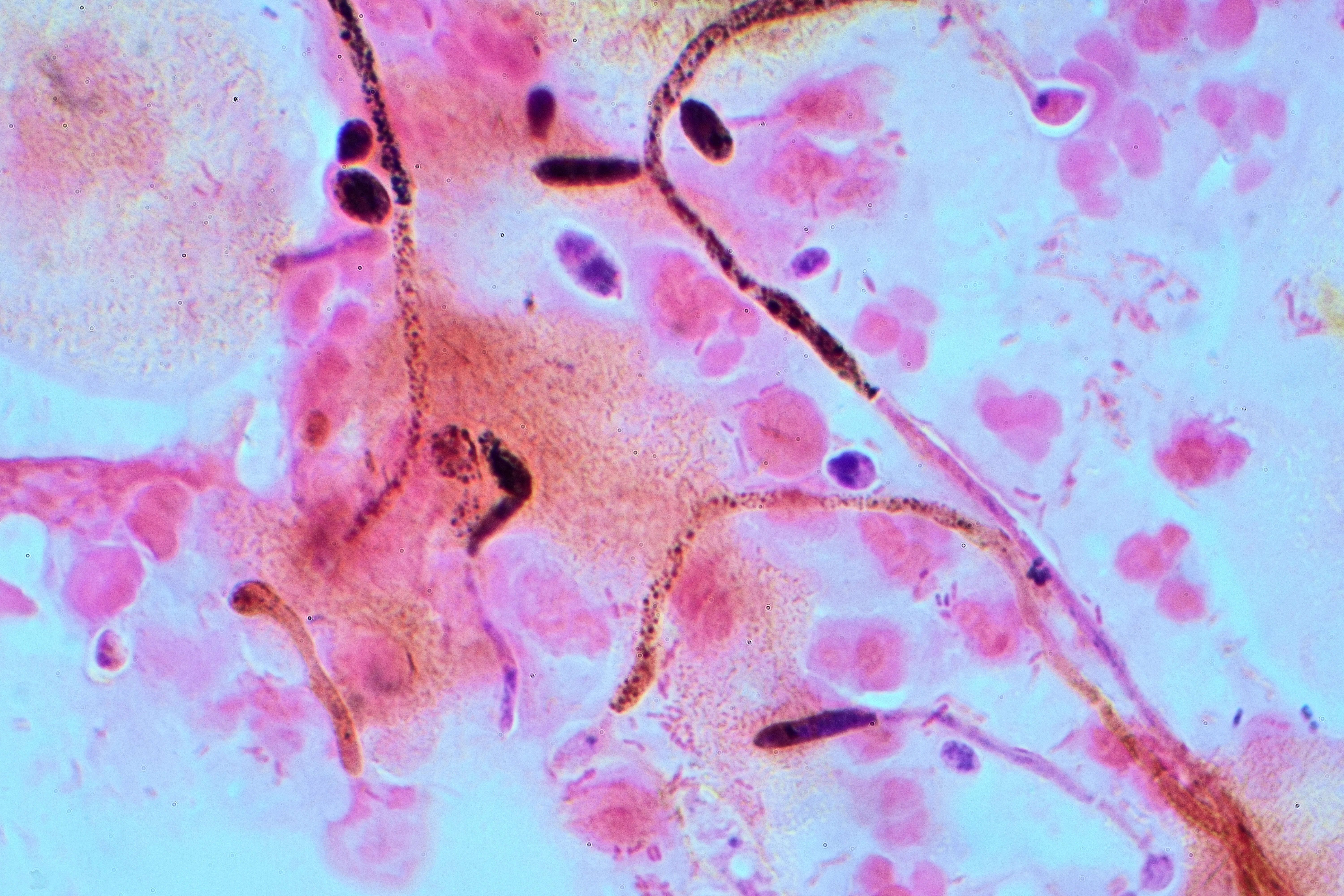 Imagem de unclassified Saccharomycetales