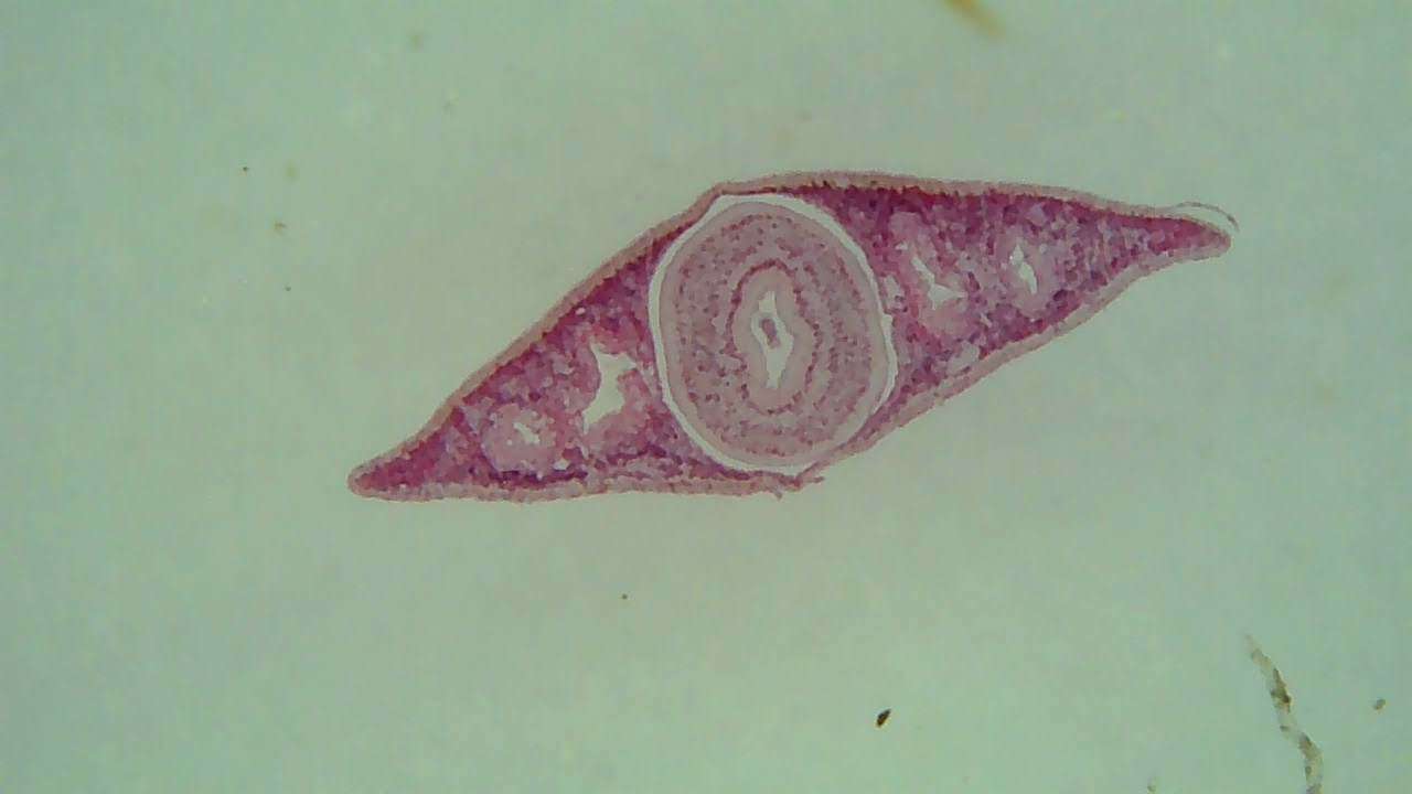 Image of Planaria