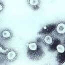Image of Human coronavirus OC43