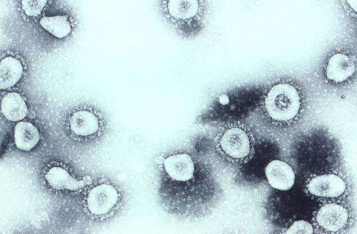 Image of Human coronavirus OC43