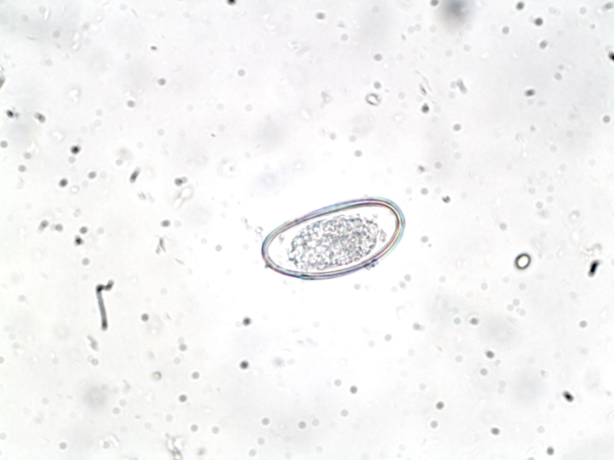 Image of Pinworm