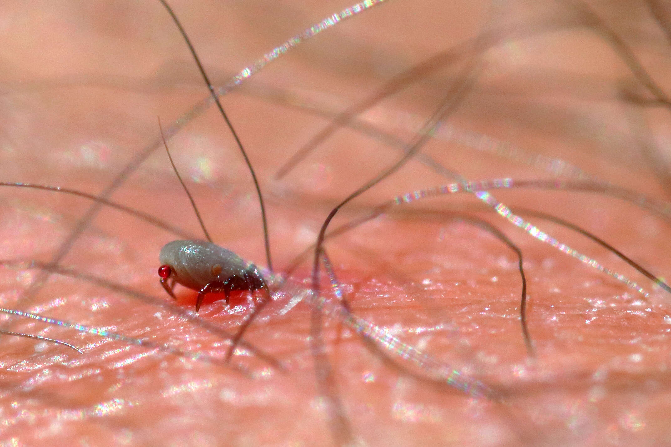 Image of Common sheep tick