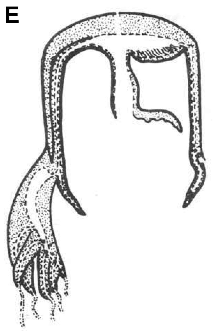 Image of Chiropsalmus Agassiz 1862