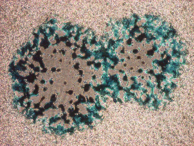 Image of Vaccinia virus