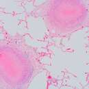 Image de Pneumocystis jirovecii Frenkel 1976