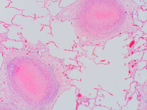 Image of Pneumocystomycetes
