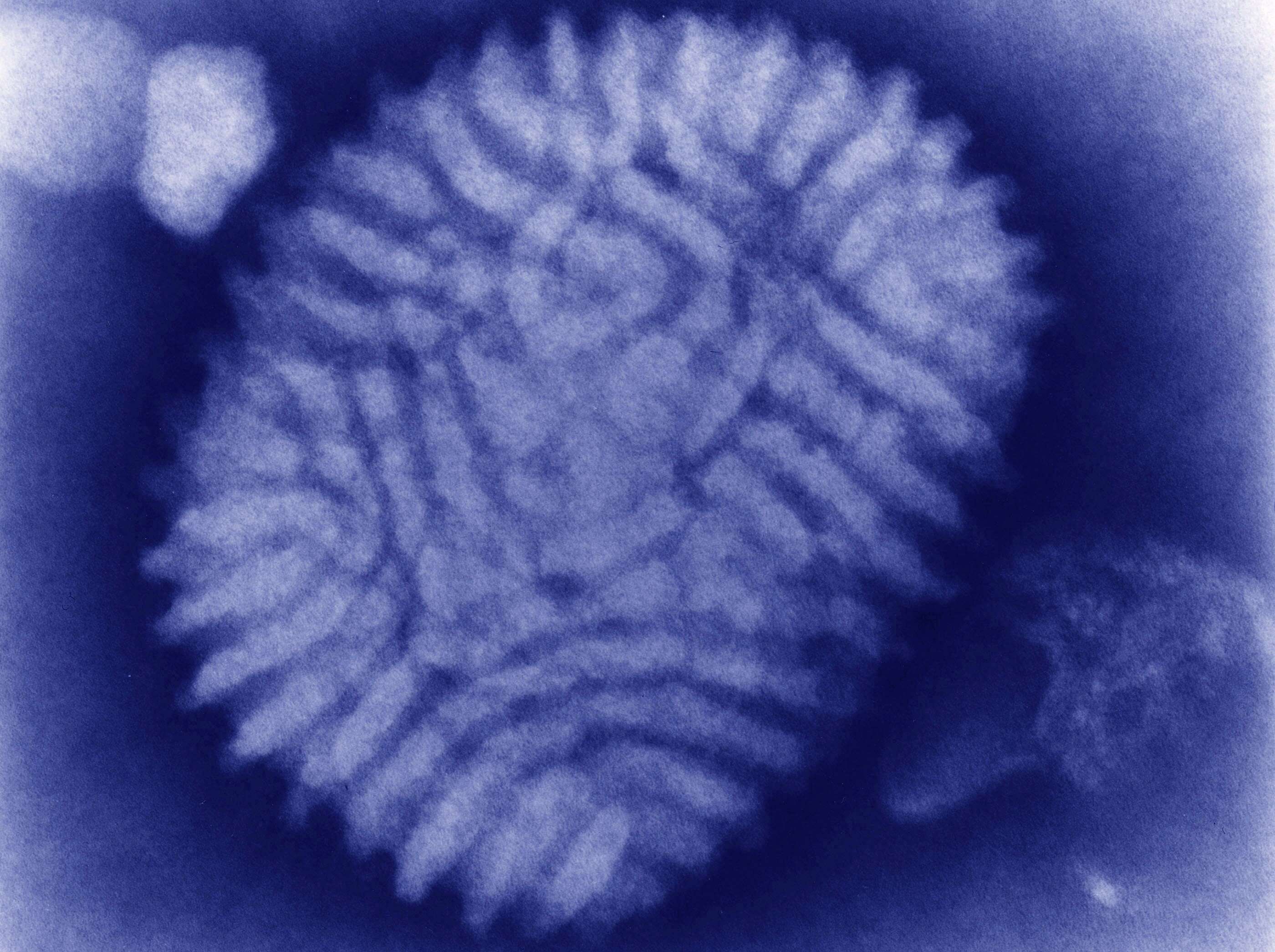 Image of Leporipoxvirus