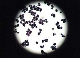 Image of unclassified Saccharomycetales