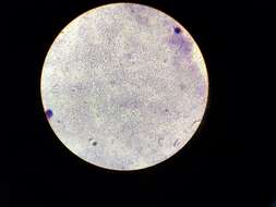 Imagem de Streptococcus pneumoniae