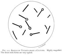 Imagem de Clostridium tetani