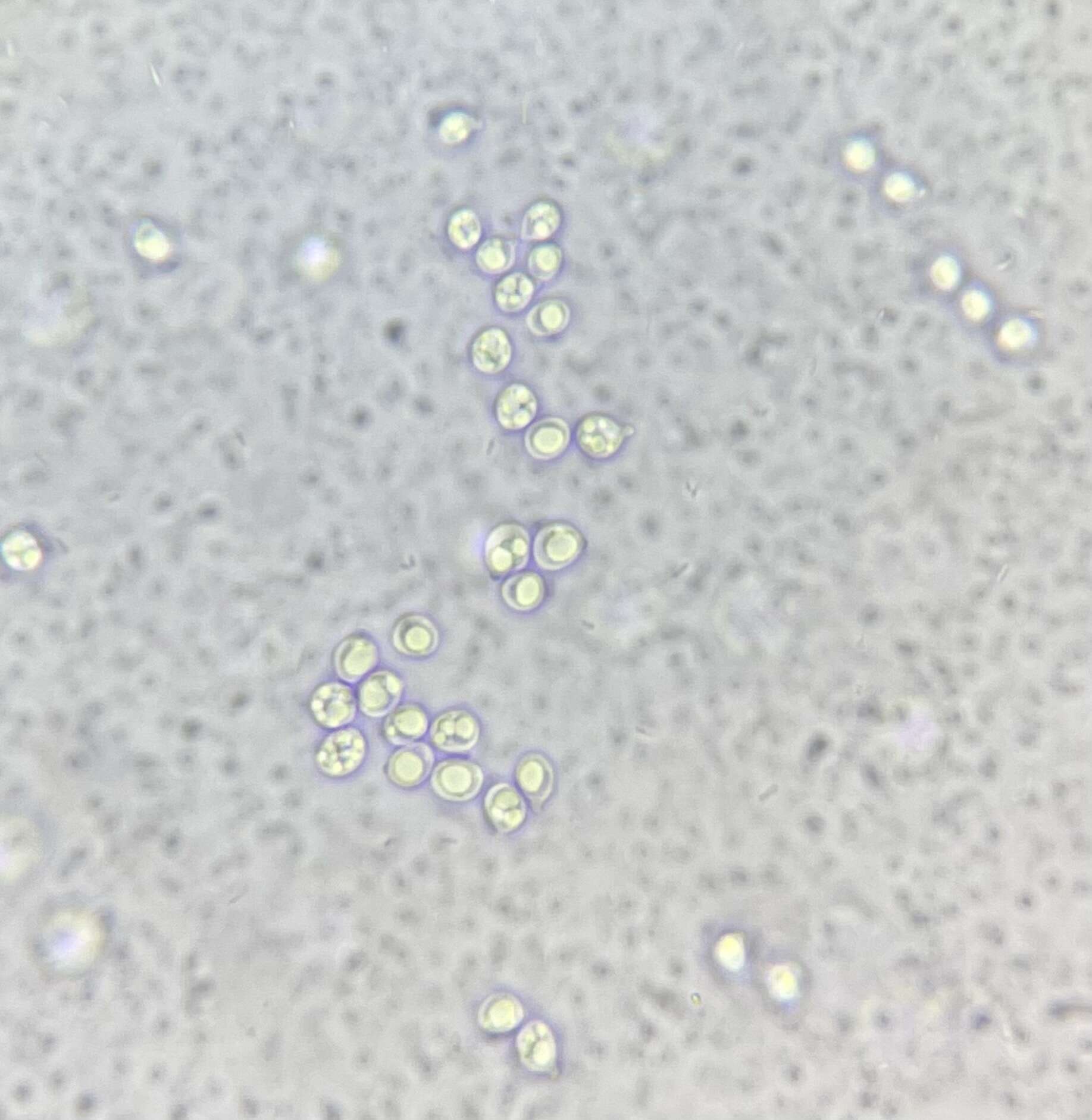 Image of Tricholoma apium Jul. Schäff. 1925