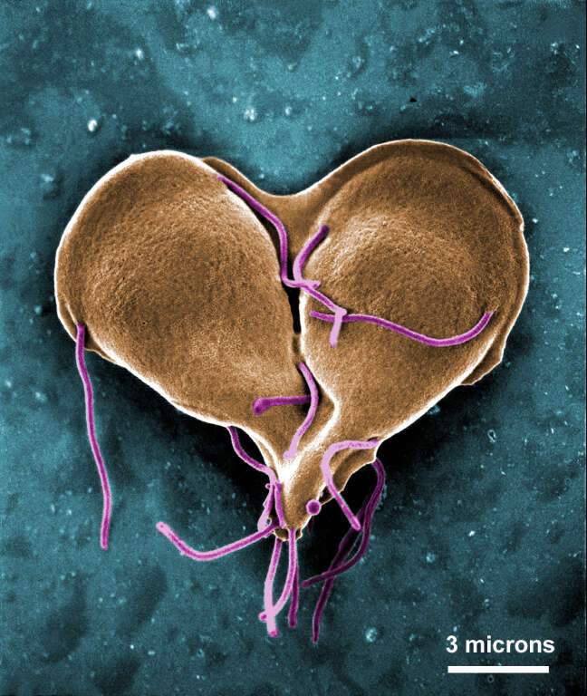 Слика од Giardia intestinalis