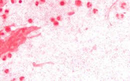 Image of Haemophilus influenzae