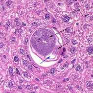 صورة <i>Capillaria hepatica</i>